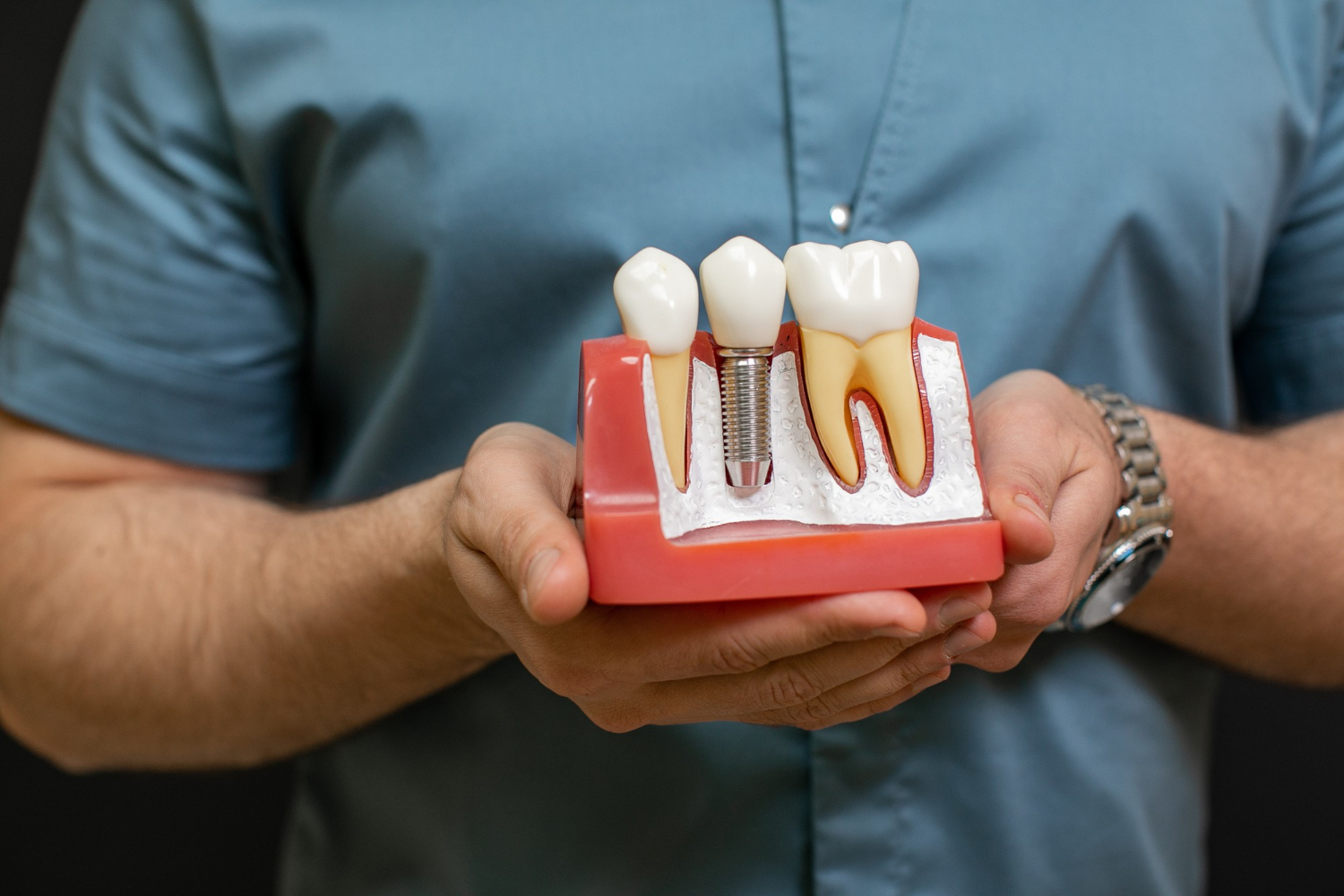 Denti Fissi Low Cost